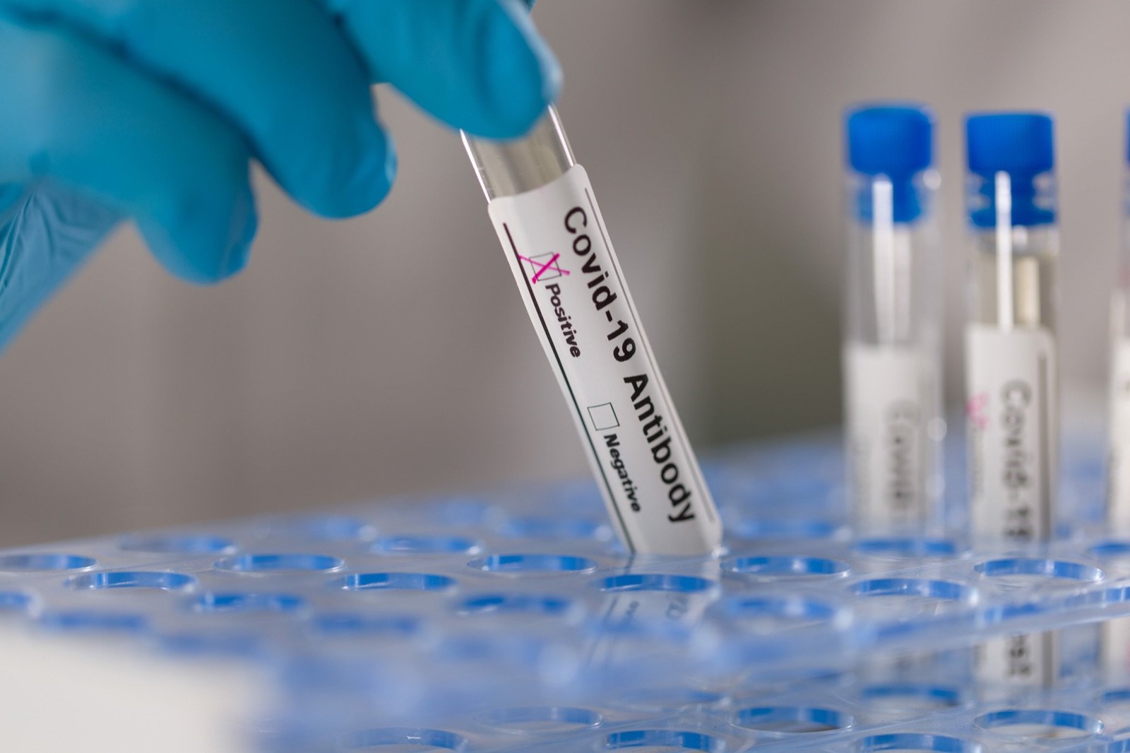 A blood draw for a COVID-19 IgG antibody test at Atlanta Urgent Care